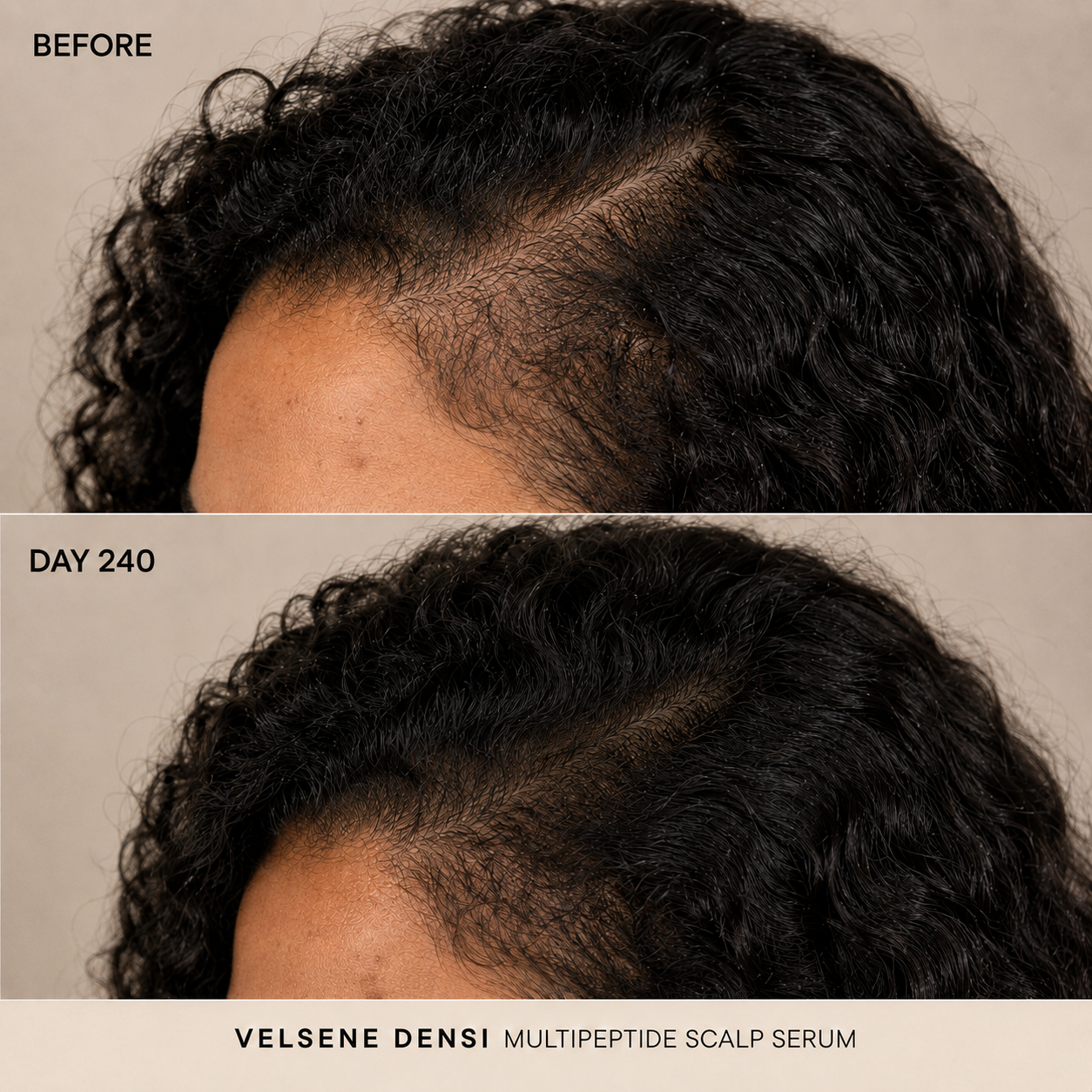Before and After — Velsene DENSI