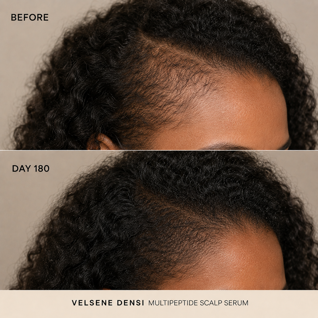 Before and After — Velsene DENSI