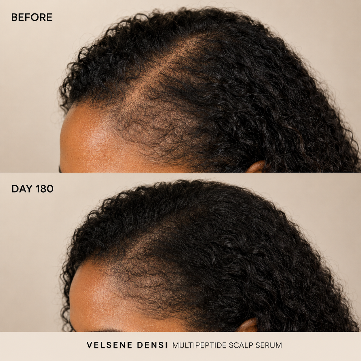 Before and After — Velsene DENSI
