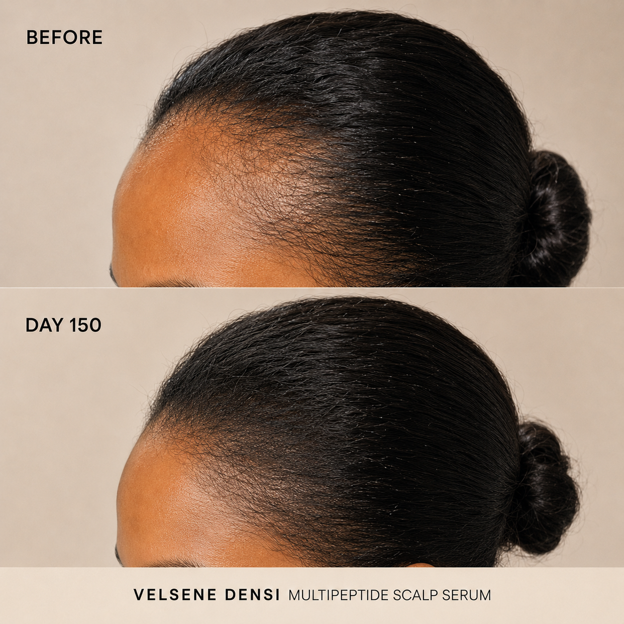 Before and After — Velsene DENSI