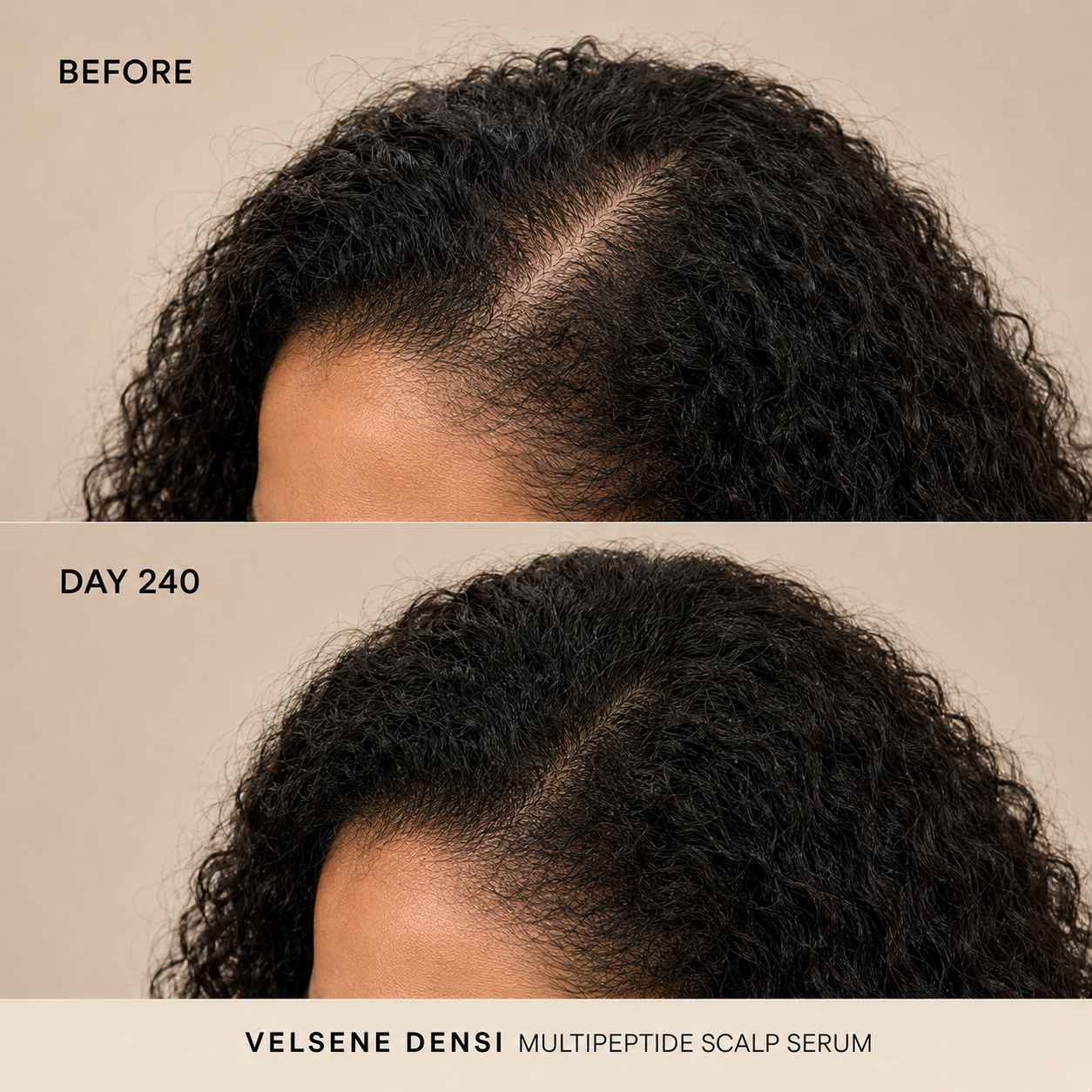 Before and After — Velsene DENSI