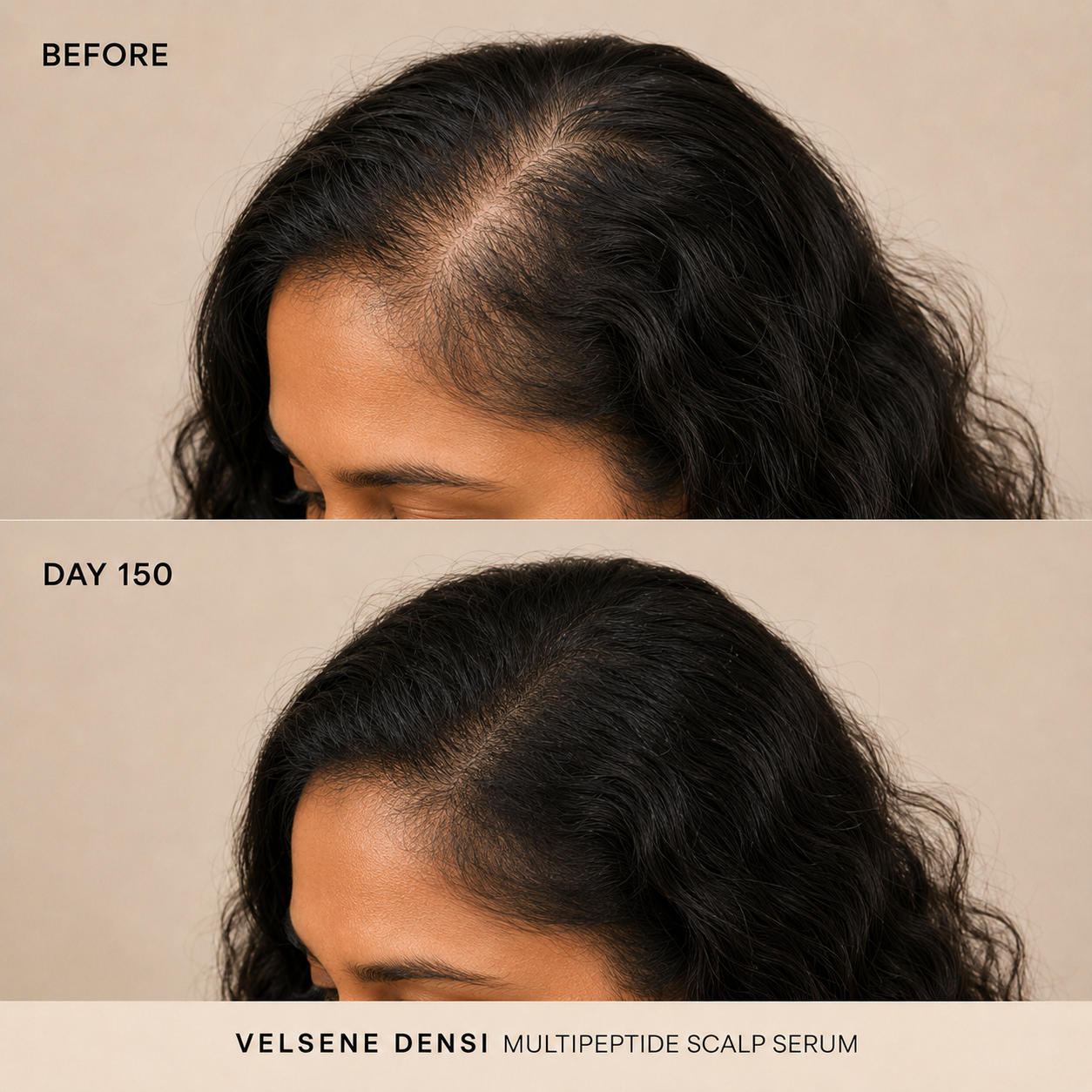 Before and After — Velsene DENSI