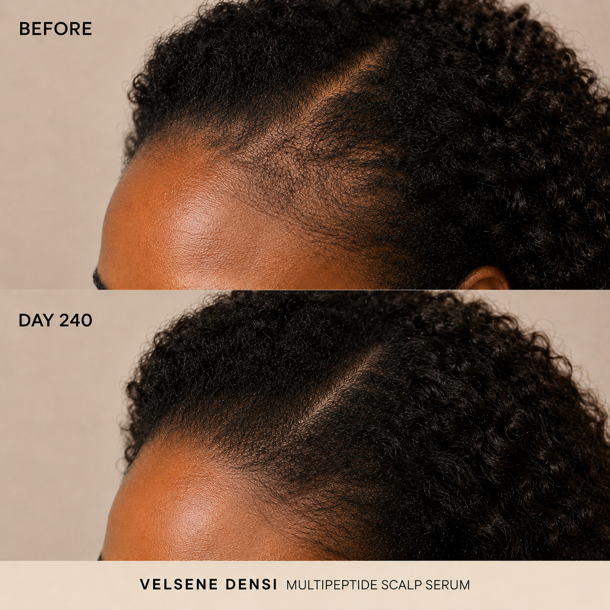 Before and After — Velsene DENSI