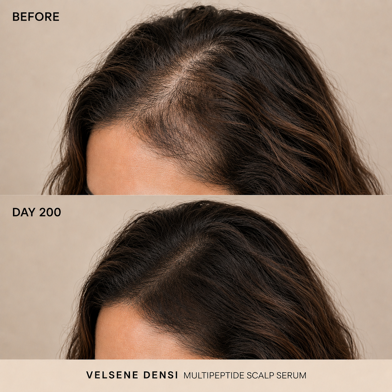 Before and After — Velsene DENSI